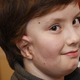 Illustration for article titled Kid Gets a New Ear Made from His Own Rib
